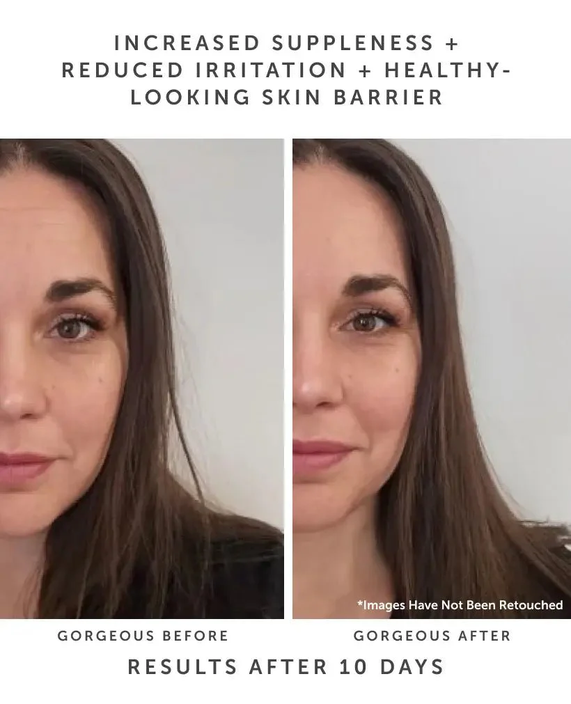 Horizon | Ceramide Barrier Serum - Image 5