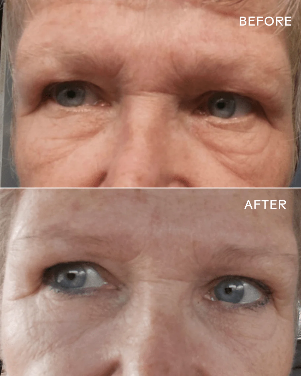 EyeHero™ Bio-Retinol Smoothing Eye Cream - Image 4