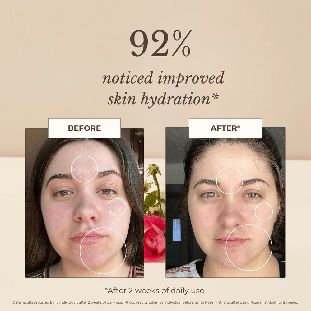 Rose Essential Hydration Mist - Image 3
