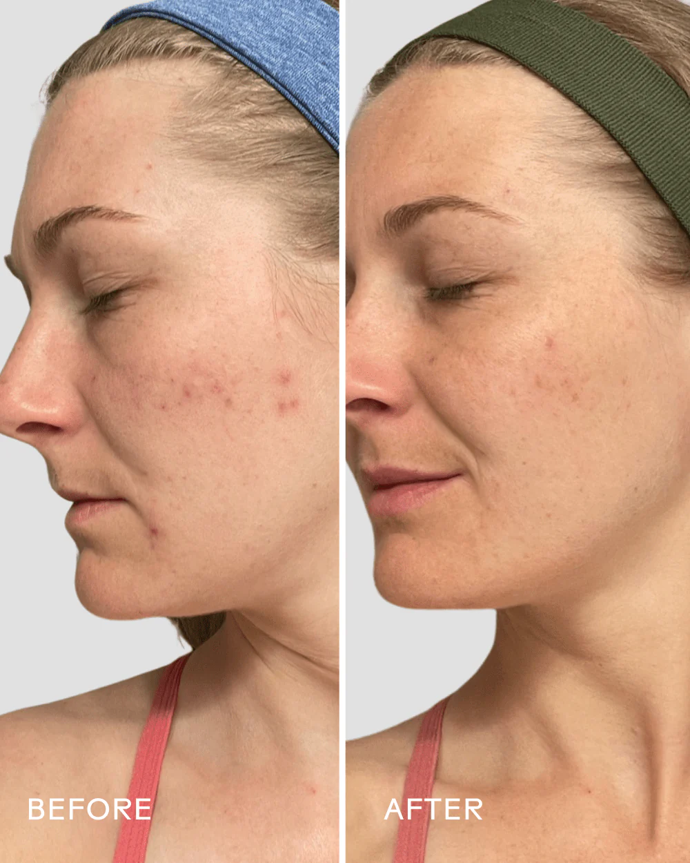 Refresh Papaya & Salicylic Acid Cleanser - Image 5