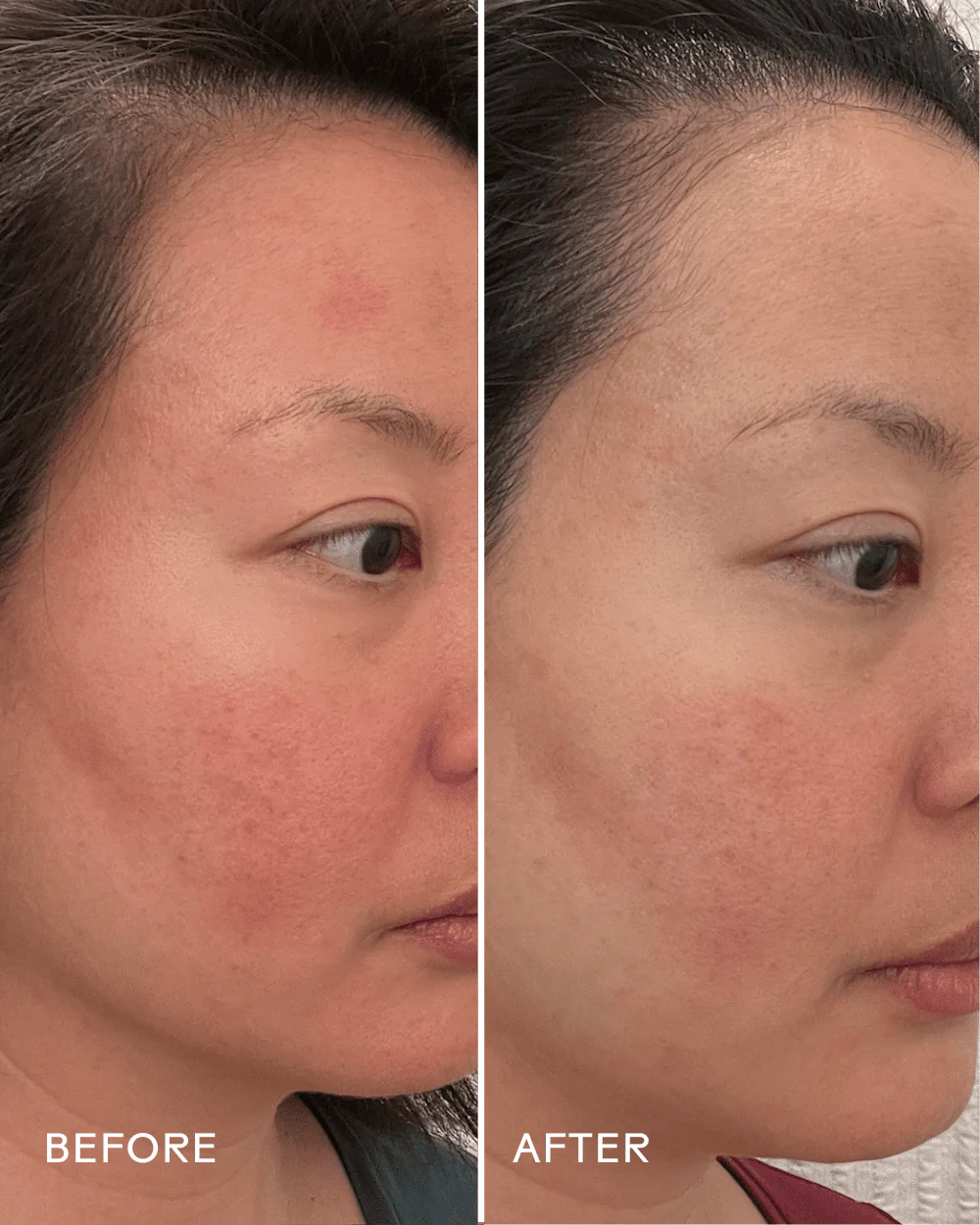 Replenish Ceramides & Blueberry Barrier Repair Serum - Image 5