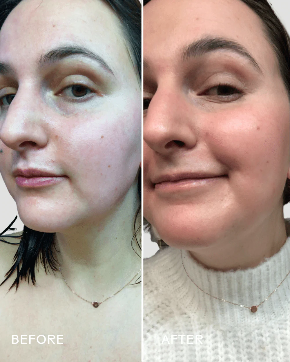 Boost 49% Rosehip Oil Serum - Image 5