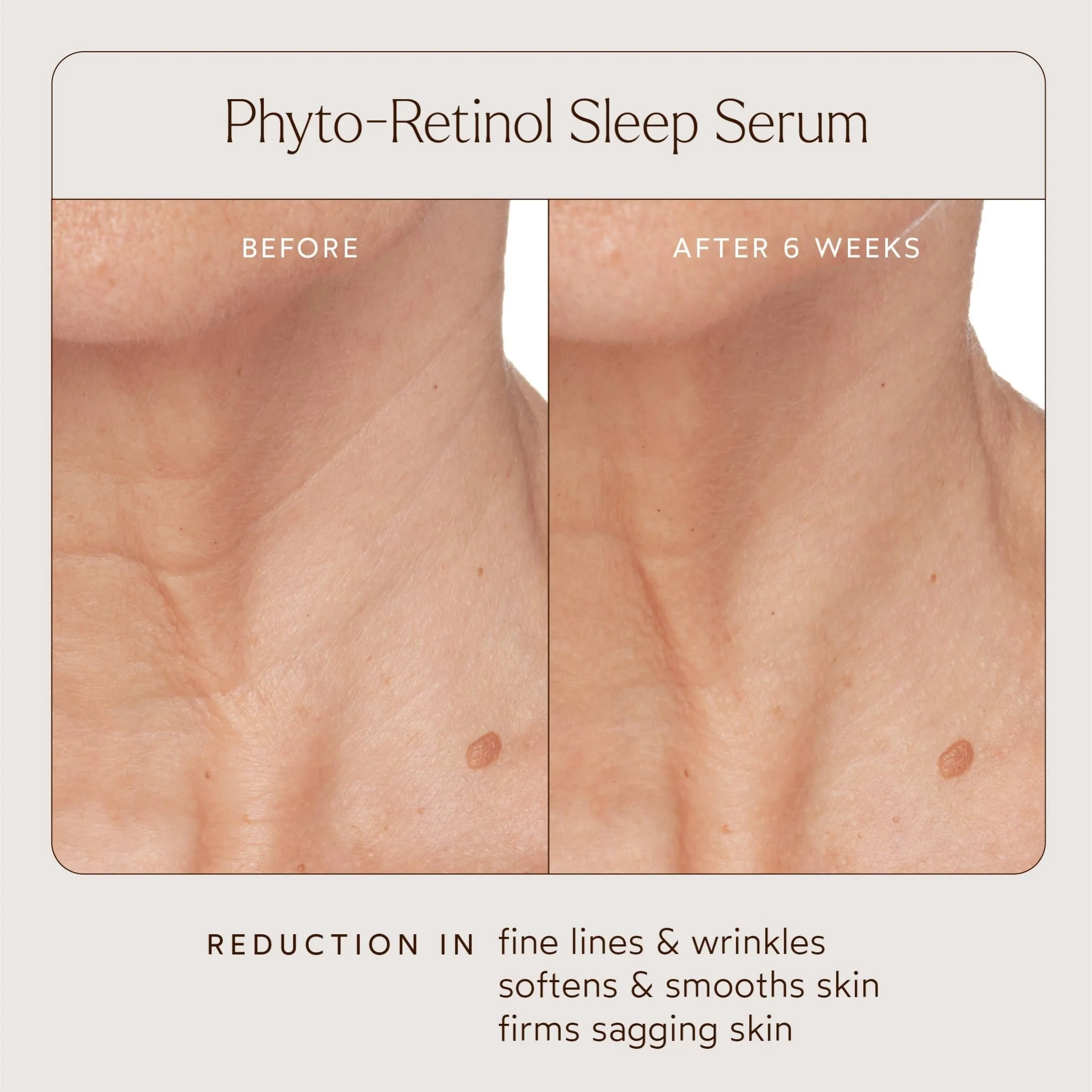 Phyto Retinol Anti-Aging Sleep Serum - Image 5