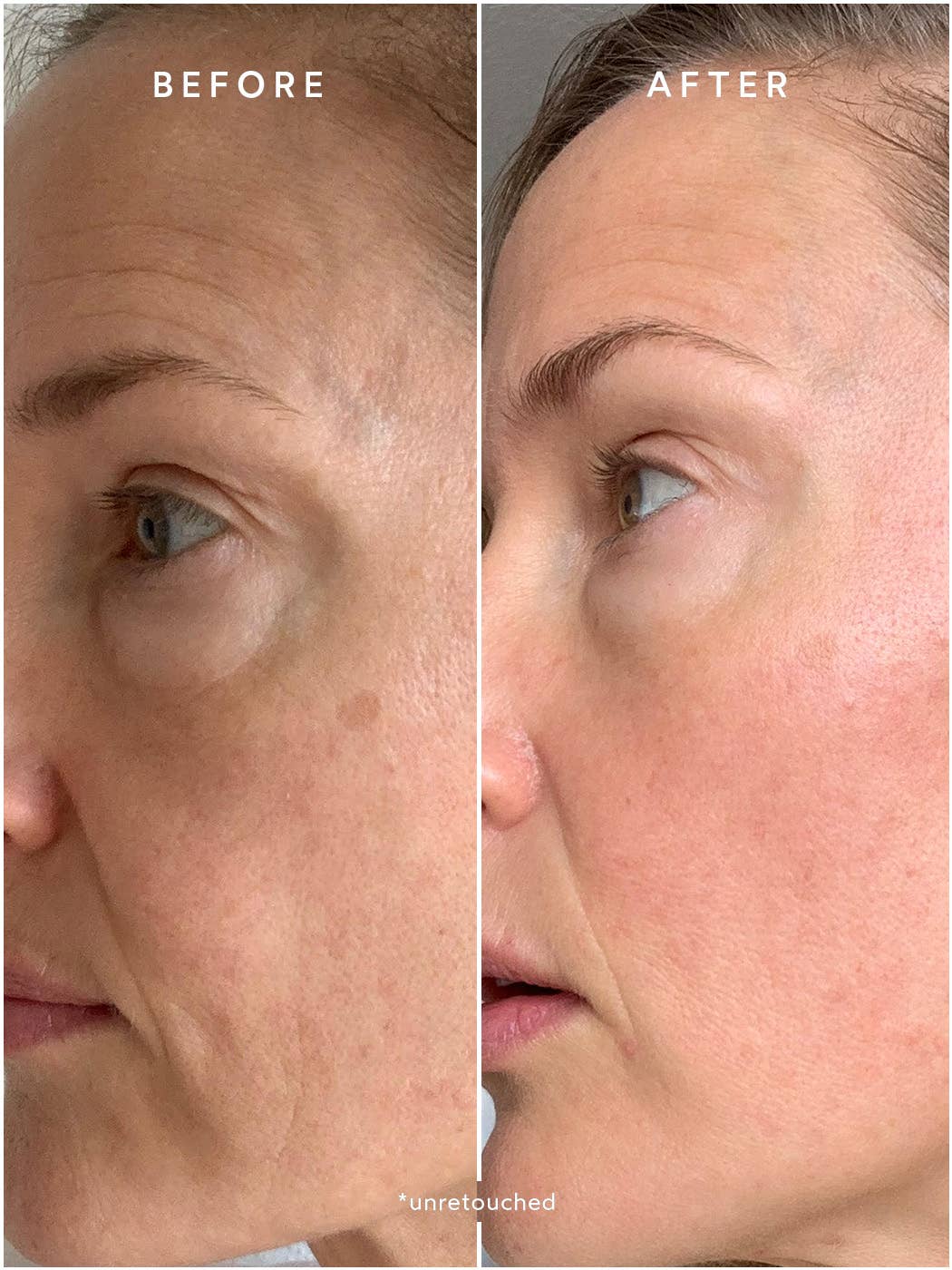 Renew Chebula Active Serum - Image 4