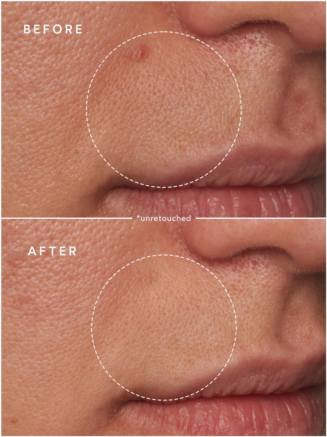 Renew Microbiome Enzyme Essence - Image 2