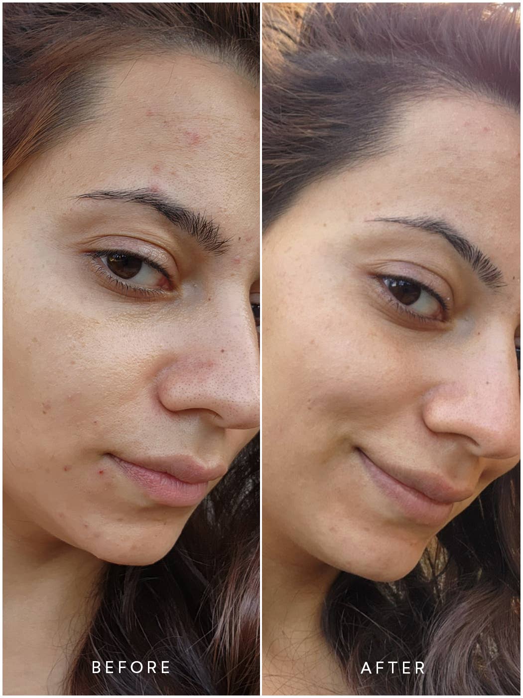 Renew Pure Radiance Oil - Image 6