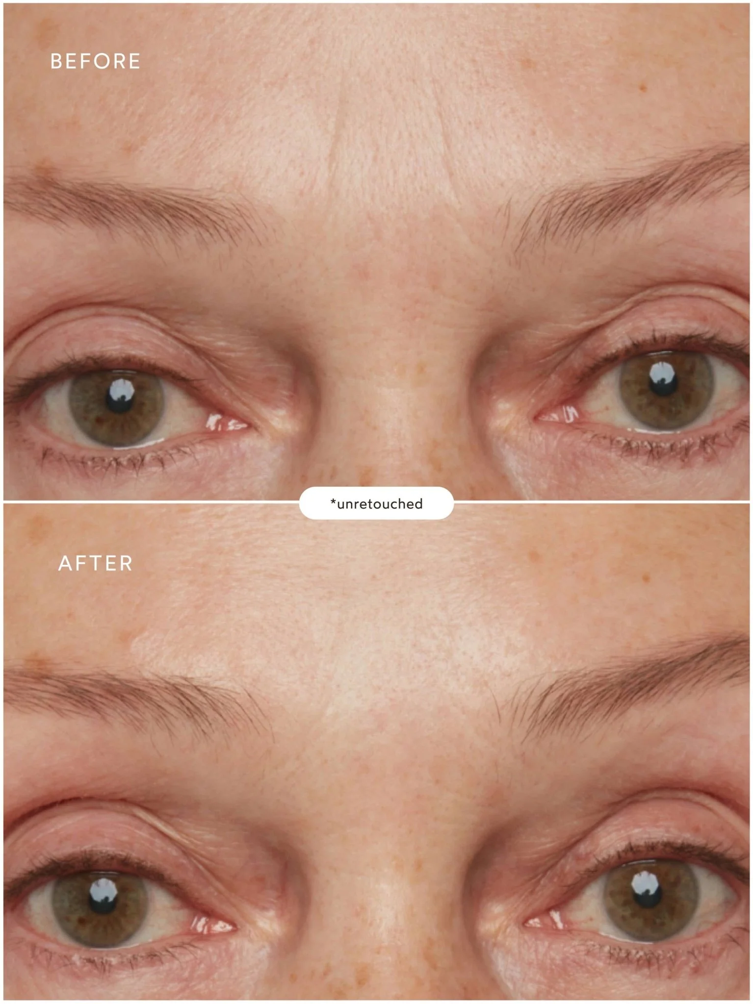 Renew Pure Radiance Oil - Image 7